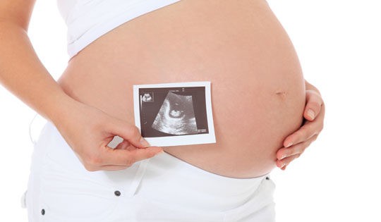  Mujer embarazada con la fotografía de una ecografía