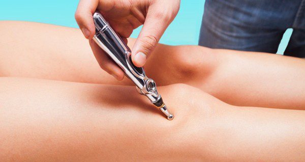 La acupuntura ayuda a reducir la retención de líquidos en las piernas