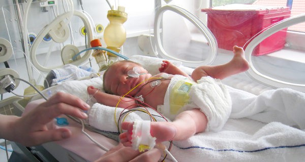 Bebé prematuro en la incubadora