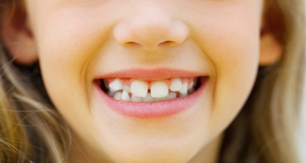 dientes de niño