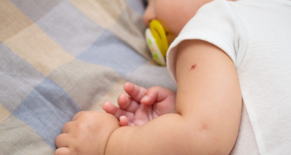 bebé con marca de la vacuna