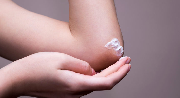 Las lesiones aparecen en zonas coo codos, rodillas o mejillas
