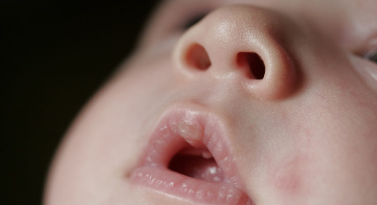 El aleteo nasal se identifica porque la nariz se abre demasiado al inspirar
