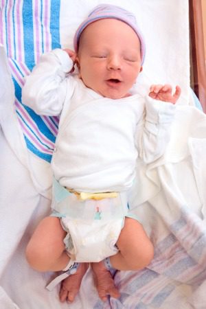Bebé recién nacido con pinza en el ombligo