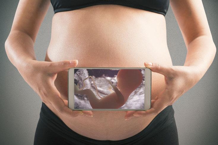 Un 30 por ciento de las embarazadas tendrán placenta previa