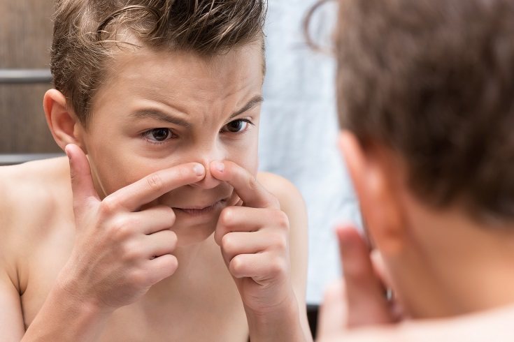 Las hormonas influyen en el acné de los adolescentes porque activan la glándula sebácea de la piel