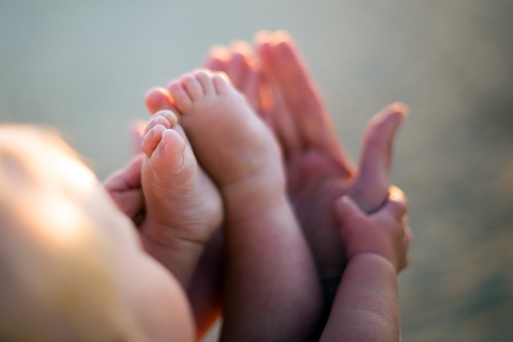El angioma infantil es más frecuente en bebés prematuros o de bajo peso al nacer
