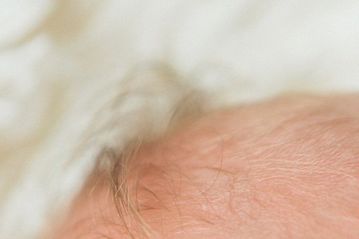 Las causas de la aparición de costra láctea en el cuero cabelludo pueden ser varias