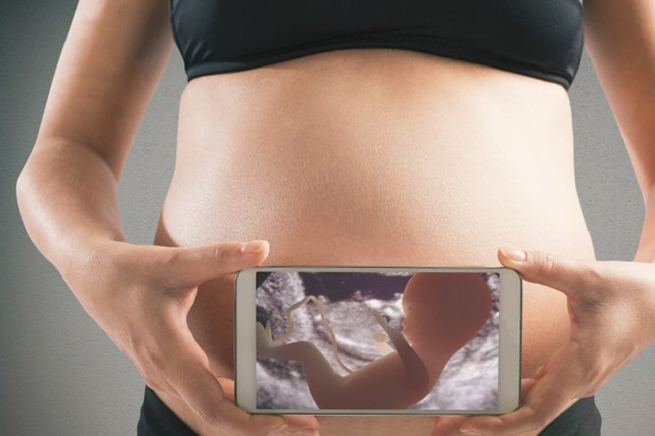 La abrupción placentaria grave es un factor de riesgo importante para la muerte fetal
