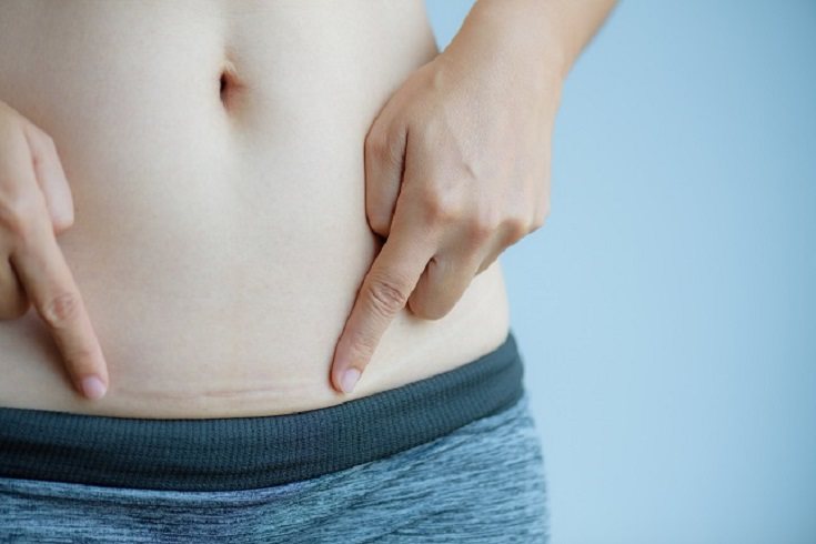 Tus músculos abdominales se estiran y se debilitan durante el embarazo 