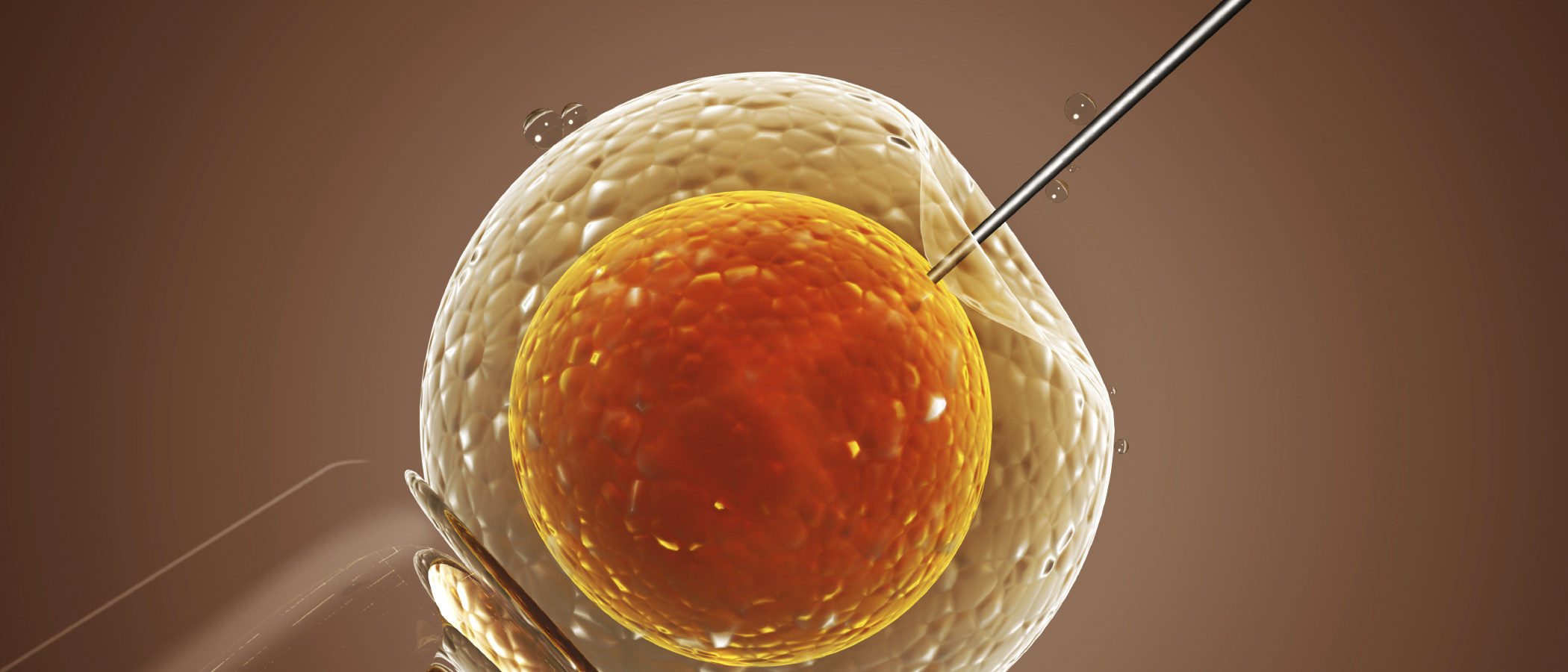 Las diferencias entre inseminación artificial y fecundación in vitro