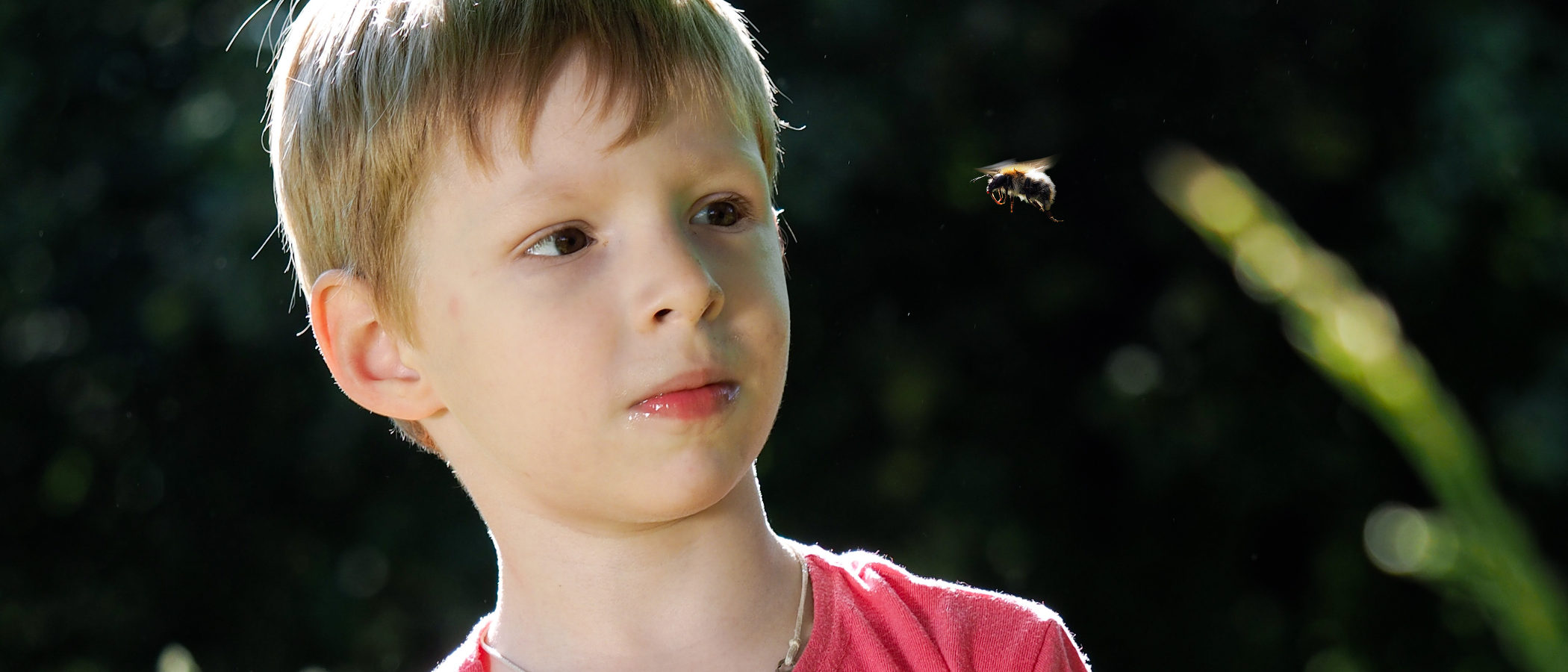 Qué hacer ante las picaduras de abeja en niños