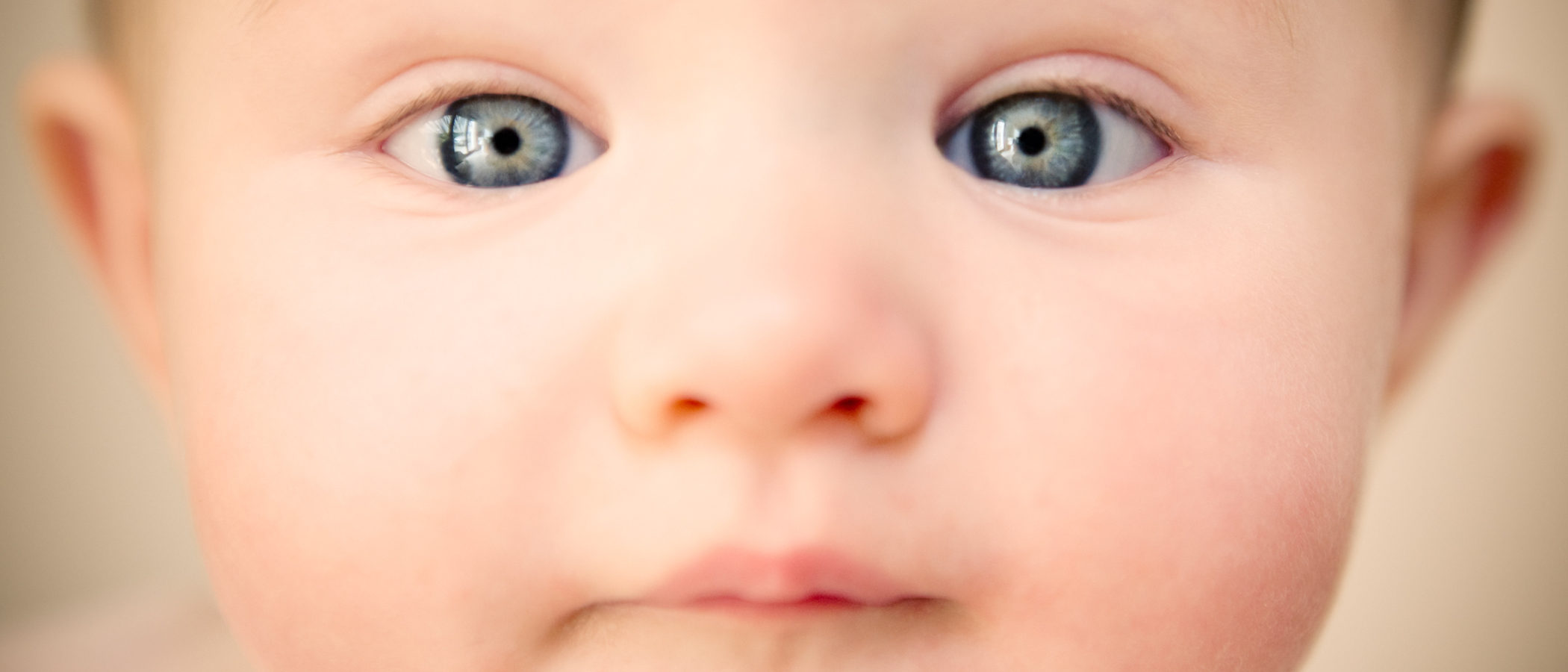 Estrabismo en el recién nacido, un desvío temporal y normal de los ojos del bebé