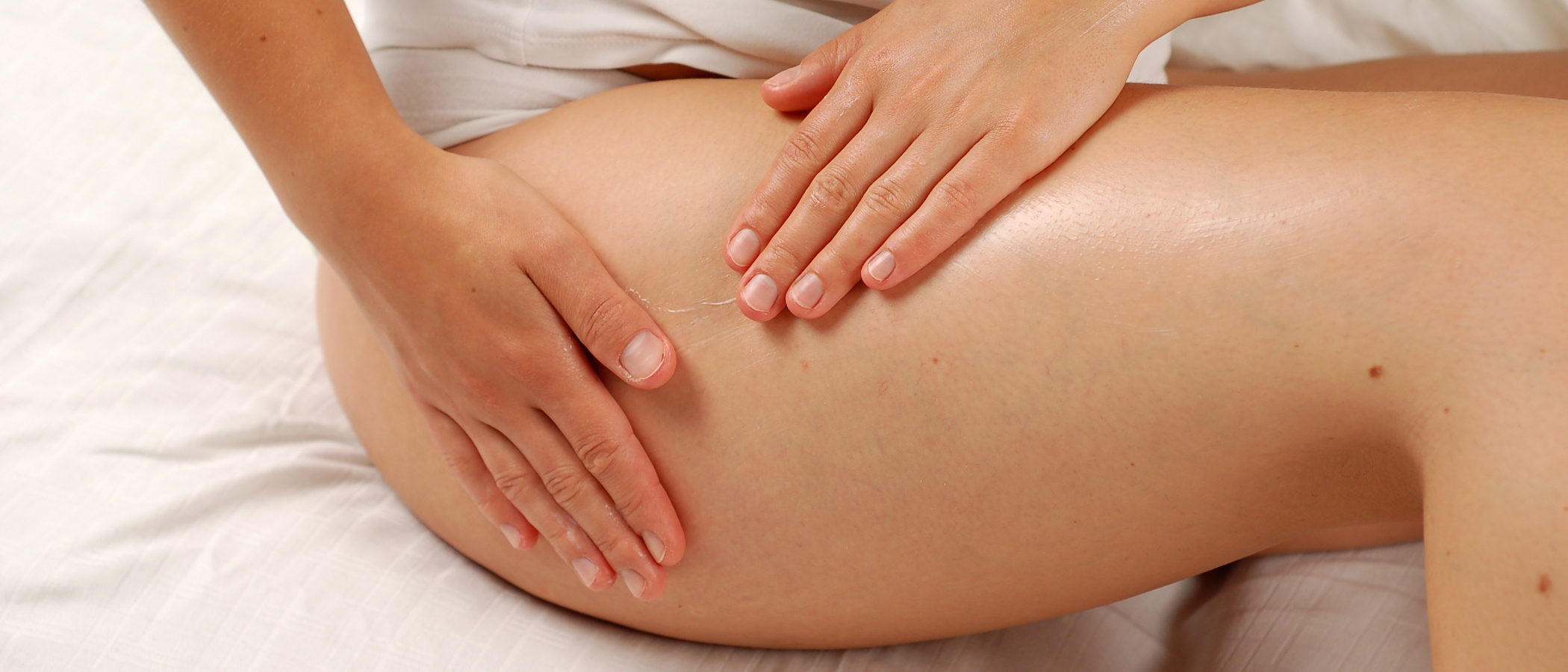 5 consejos para prevenir la celulitis en el embarazo