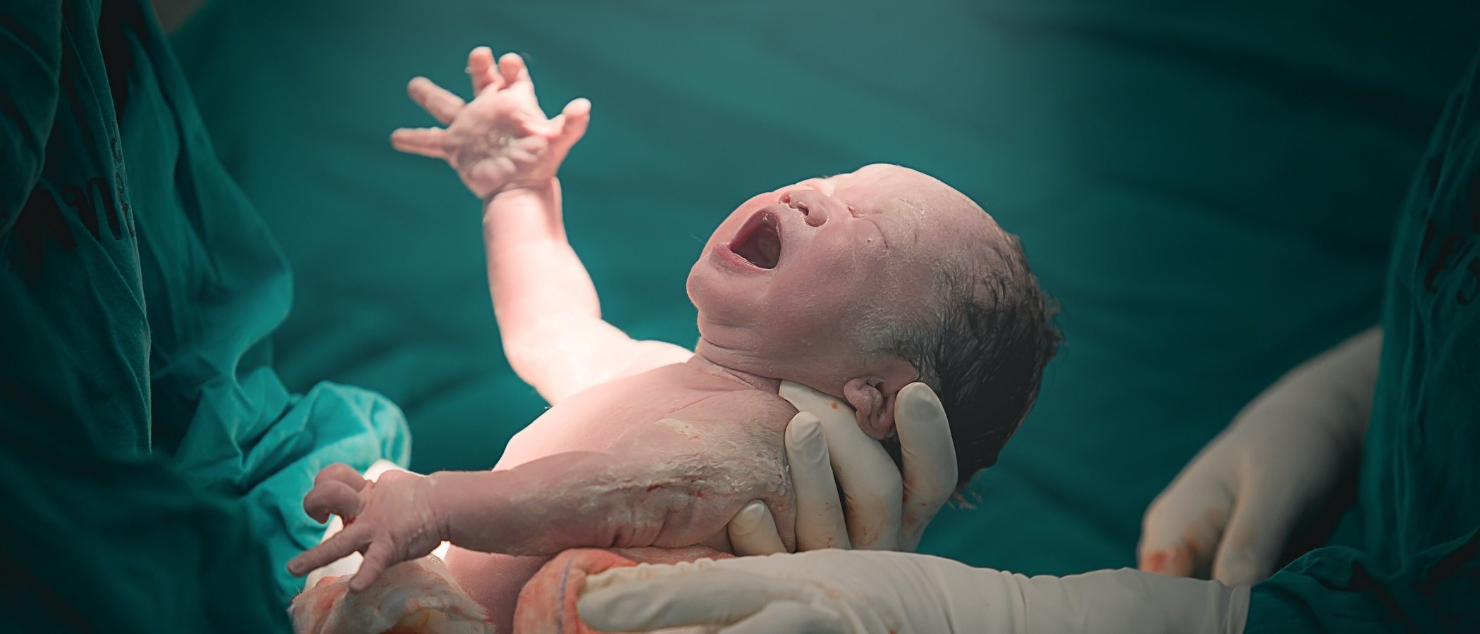 5 formas de evitar el desgarro en el parto