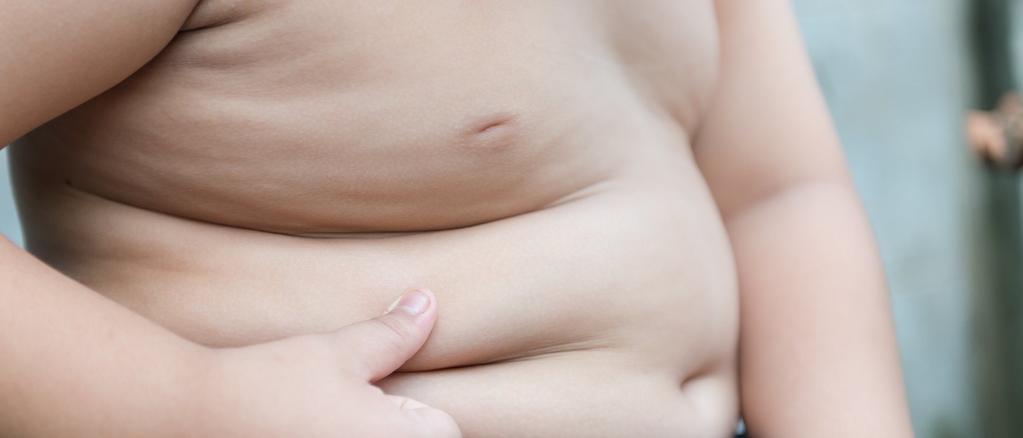 Qué deben saber los padres para evitar la obesidad infantil