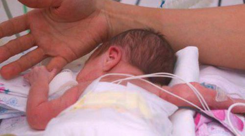 Los riesgos y peligros para el bebé prematuro
