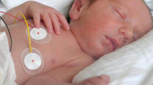 El bebé que nace con espina bífida, ¿qué consecuencias le traerá en el futuro?