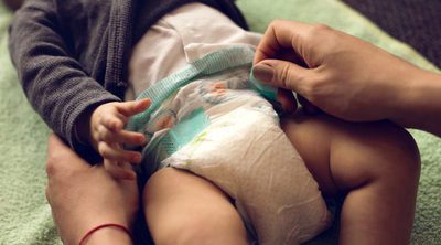 Dermatitis del pañal en los bebés