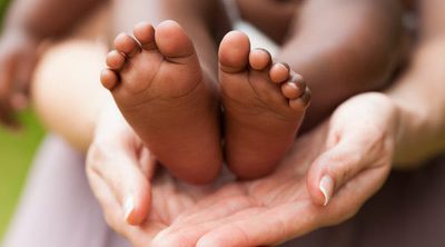 Tratamientos para corregir los pies planos en niños