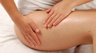5 consejos para prevenir la celulitis en el embarazo
