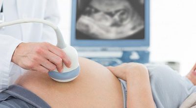 Ultrasonido en el embarazo, ¿para qué sirve esta prueba?
