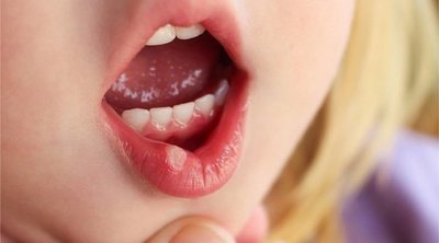 La enfermedad del boca-mano-pie