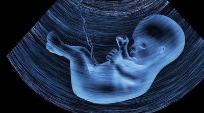 Posibles causas del aborto involuntario en el segundo trimestre de embarazo